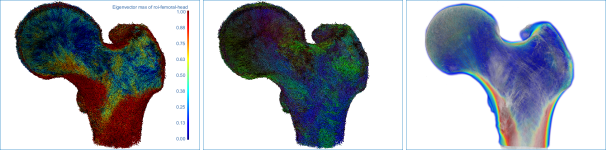 Mappings of anisotropy and volume fraction