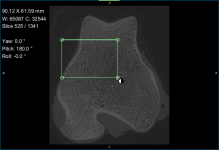 Window leveling tool