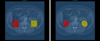 Labeled multi-ROI