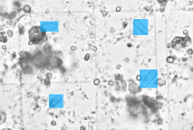 Yeast cells