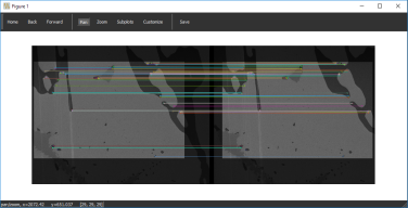 Slice Registration preview window