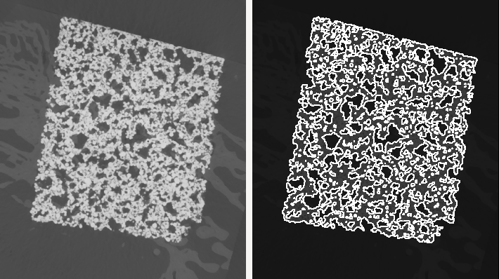 Contour mesh