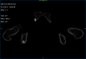 Active contour preview.