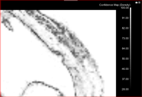 Confidence map