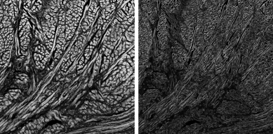 Membrane projections