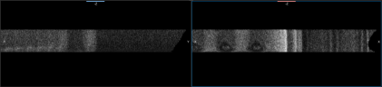 Lateral views