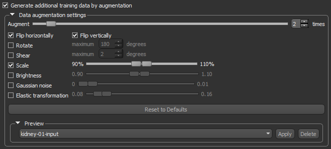 Data augmentation settings