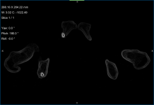 Active contour preview.