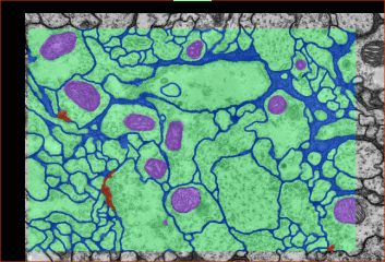 Segmentation preview